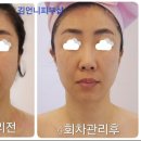 김언니피부샵 | 서산피부관리 김언니피부샵 윤곽관리