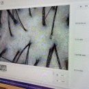 우리은행 횡단보도 | 안양 평촌 두피관리 [ 닥터모락 평촌점 ] 재방문 후기