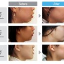 치아나라치과의원 이미지