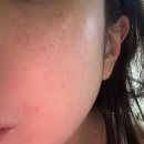 폼메디칼 | [주닥]프로폴리스 젠틀 클렌징 폼 약산성 클렌징 폼 사용 후기