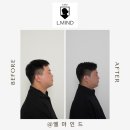 J3165 | [공지] 인천탈모, 도대체 어디로 가야할까요?
