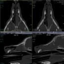 서울동물영상종양센터 | 비강종양 Cryo Surgery로 병변 제거 및 회복 성공한 중형견 사례│로얄동물외과수술센터