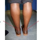 메디앤핏 이미지