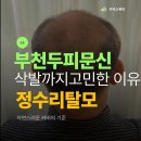 카리스(charis)헤어 | 부천두피문신 삭발 고민한 이유