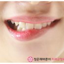 바른이턱치과의원 이미지