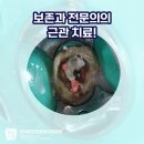 반석치과의원 | 치아 분지부 천공, 숨어 있는 신경관까지 꼼꼼하게 찾기! 광화문치과