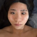 엠미용재료 | [웨딩관리] 청라윤곽관리, 림프관리 잘하는 비쥬에스테틱 후기