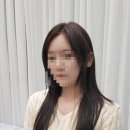 다연헤어라인 이미지