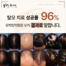 모플러스 | 20대탈모, 탈모샴푸로 해결될까요? 교대역탈모병원에서 안내합니다