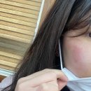 박미순피부과의원 네이버블로그