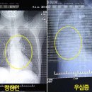 장기 뒤바뀐 중국 소년 이미지