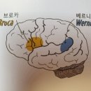 베르니케 이미지