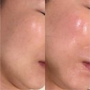 진해대로 | 진해에스테틱 예쁨온스킨 민감피부 필링 관리 후기