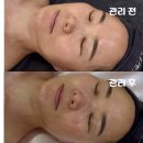 진주산소 | 마산피부관리_스킨글로우 비타진주케어 후기 (수분+재생+안티에이징) 피부가 환해졌어요^^