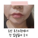 톤즈의원 동탄점 | 입술필러 후기 💋 동탄 입술필러는 동탄톤즈의원에서!