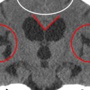 건강한뇌신경과의원 이미지