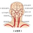 건망증 없애는 방법 6가지 이미지