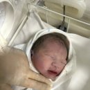 디데이 :) 40주 0일 린 산부인과 제왕절개 후기