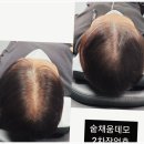 부산 숱채움커버 잘하는 더찍다아카데미 완전 추천!!