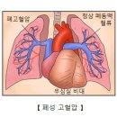 성이