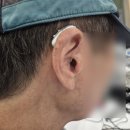 쌍문독일보청기 | 도봉구보청기 찾으실땐 쌍문독일보청기 이용해보세요
