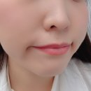 (주)메디바이오템 | [제품리뷰] 큐어토리 붙이는 스킨부스터 72샷 메디팩 바이오셀룰로오스 4일 실사용후기