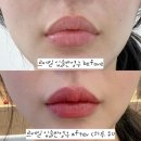 3234 | 선릉 르베일 입술 반영구 내돈내산 후기 | 오버립 입술 비대칭 교정