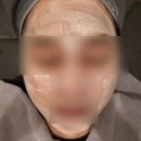 진정한의원 | 천안 피부 전문 한의원에서 모낭염 진정관리 후기