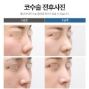 리미트성형외과의원