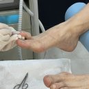 풋스올 노원점 | 노원무좀 노원발관리 강력 추천 풋스올 노원점 무좀 케어 대만족 후기