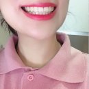 [안양 평촌 치과 추천] 평촌 예미담 치과 윗니 교정 후기