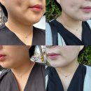 링크정보시스템(주) | 진주 피부관리 소솜에스테틱, 단 1회만에 리프팅 효과 후기