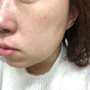(주)예리코코리아 | [겨울철 피부관리]건조한 피부 팔자주름관리 이하늬앰플 추천: 실리프팅앰플DA99 솔직후기
