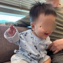 김&정해운대병원 | [대구 닥터지니] 7개월 아기, 눈 옆 선천성 멜라닌모반&amp;부유두 당일수술 후기 (부산에서 대구로)