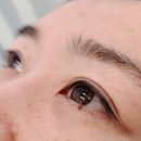 더예쁜eye 이미지