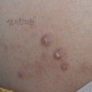 양진한의원 네이버블로그