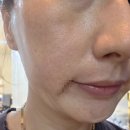 라이콘스파에센셜 블랑레니 왁싱