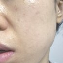 모공관리 올가휴 이지 핏 포어 마스크