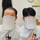 남자 탈모 고민 끝! 서울 영등포 여의도 김앤장가발로 자연스럽게 젊어지는 법