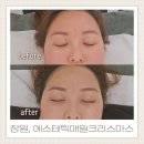 매일매일 | 창원 피부관리 사림동 에스테틱매일크리스마스에서 스킨플래닝 받은 후기