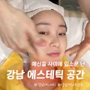 강남역 피부관리 에스테틱 공간, F.M 매직리프팅 탄력관리 후기