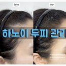 풍성풍성두피