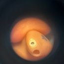 굿모닝보청기 평택서정센터 이미지