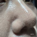 털복숭폼 | 내돈내산 뷰드 디바샷 4주차 솔직후기 화산모공관리 1개월 사용 리얼 후기