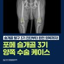 24시 더휴동물의료센터 | 부산 강아지 슬개골탈구 수술 케이스 - 잘하는 동물병원 추천 [24시 더휴동물의료센터]