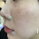 내추럴 메이크업 필수템, 힐어스 숨결 컨실러 팔레트 다크서클 커버 솔직 후기 + 프로모션