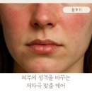우정타운 | “예민피부 맞춤 케어의 기준, 관양동 피부관리실 ‘황후가’에서 피부장벽 건강하게 만들어봐요!”