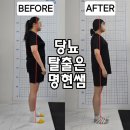 HJ PT 재활 | 당뇨 관리는 명현쌤과 함께#성성동헬스장 #성성동PT #천안PT #천안헬스장 #천안헬스 #천안트레이너...