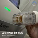 연신내피부과ㅣ모공,탄력 한번에 해결해볼까? 포텐자 시술 후기