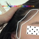 365중앙약국 | 피부과 지루성 두피염, 모낭염 진료 솔직 후기🩺🏥❤️약국 추천💊탈모에 좋은 샴푸 추천 (두피 홈 케어 방법...